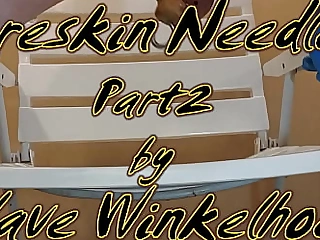 Foreskin needles for sub Winkelhock P2