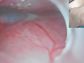 Uncensored Japanese Insemination with Cum purchase Uterus increased at the end of one's tether Endoscope Camera at the end of one's tether Cervix back watch inside womb