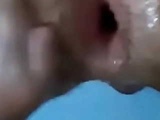 Fisting anal