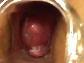Wife speculum in pussy with jizz pregnant Cervix 2