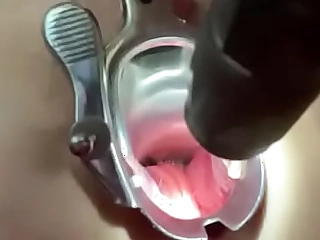 Vaginal speculum in someone's skin booty