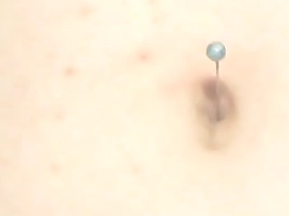 Syringe surrounding her belly button