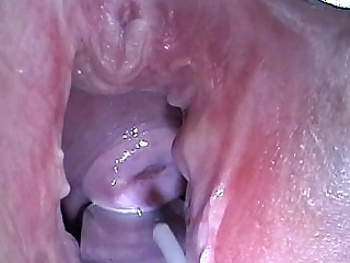 Cum Launching run wide Syringe in Cervix Utherus after Going to bed